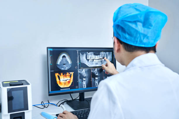 Best Emergency Dentist for Lost Fillings or Crowns in West Whittier Los Nietos, CA