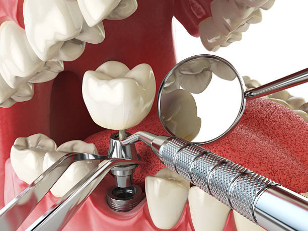 Best Mobile Emergency Dentist in West Whittier Los Nietos, CA